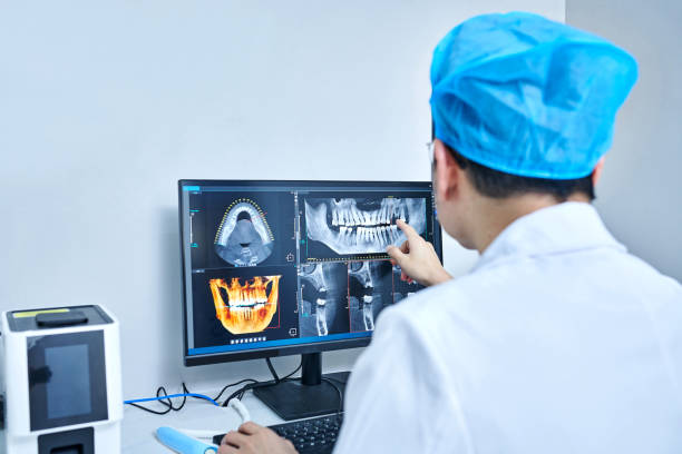 Best Emergency Dental Care for Broken or Chipped Teeth in Wilton, IA